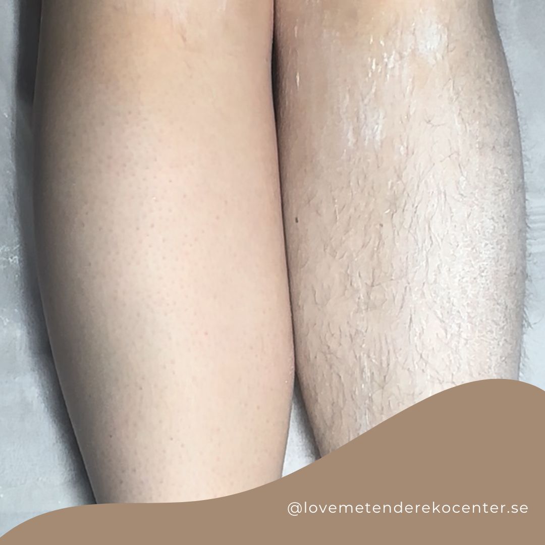 Silkeslen hud med sugaring.